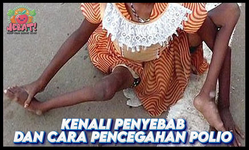 Penyebab Polio